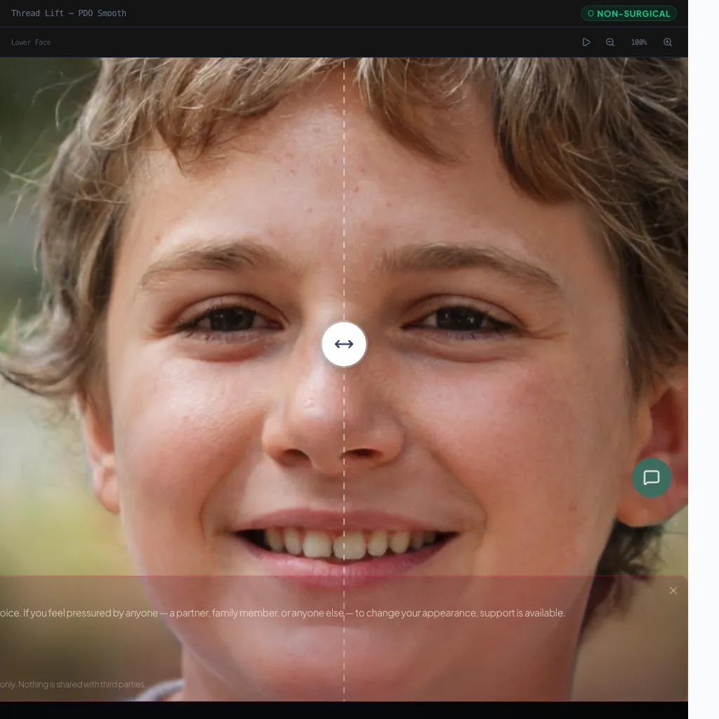 Thread Lift — Oblique View — Before